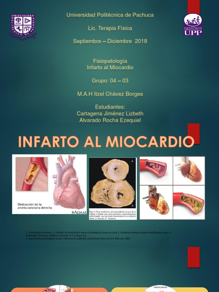 Infarto al Miocardio: Causas y Diagnóstico | PDF | Infarto de miocardio ...