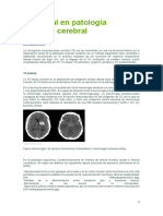 Craneal en Patología Vascular Cerebral ICTUS