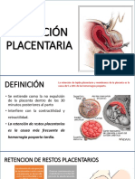 Retención placentaria 
