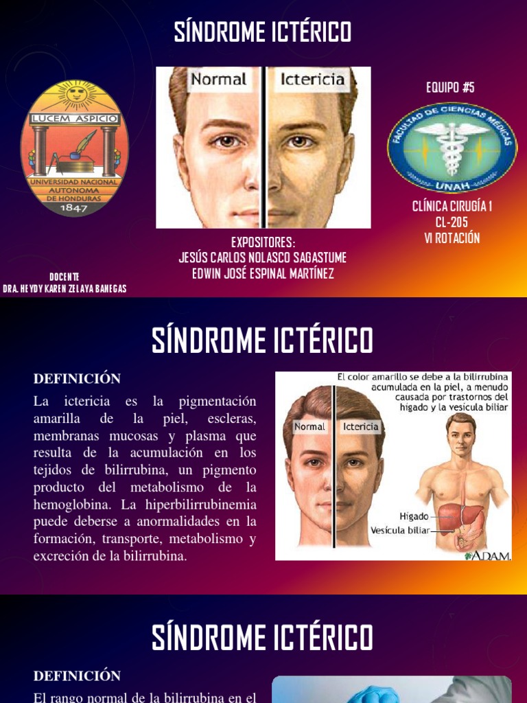 Ictericia: Causas y Diagnóstico Clínico | PDF | Transaminasa | Cirrosis