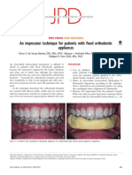 An Impression Technique For Patients With Fixed Orthodontic Appliances