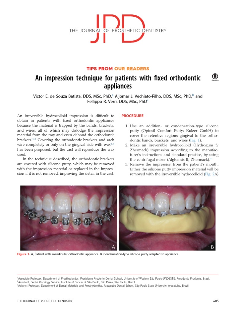 An Impression Technique For Patients With Fixed Orthodontic Appliances