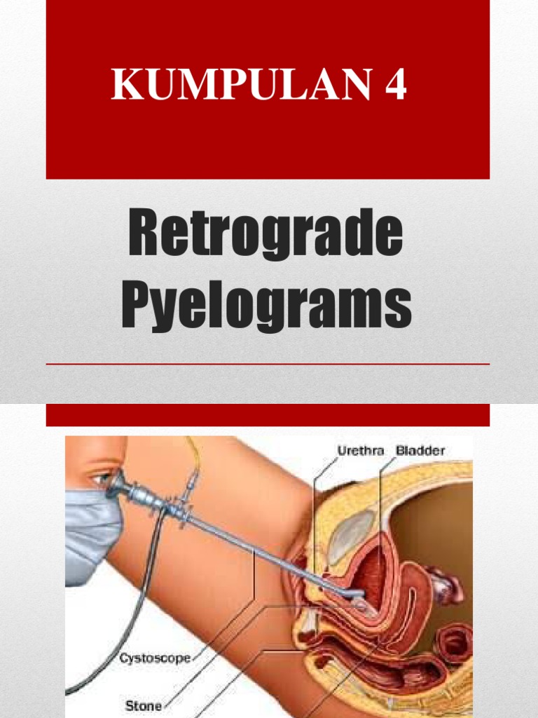 Prosedur Retrograde Pyelogram dan Cystoscopy | PDF | Pengembangan Diri
