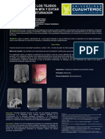 Cartel Endodoncia