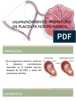Desprendimiento Prematuro de Placenta Normoinserta