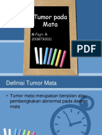 PPT Tumor Mata