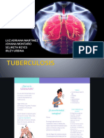 Tuberculosis