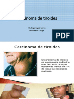 Carcinoma de tiroides.pptx