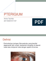 PTERIGIUM: DEFINISI, ETIOLOGI, PATOFISIOLOGI, KLASIFIKASI, MANIFESTASI KLINIS, DIAGNOSIS, TATALAKSANA DAN KOMPLIKASI