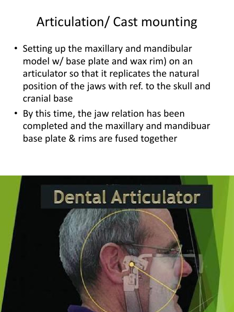 Articulation Cast Mounting and Teeth Arrangement PDF Face Dentistry