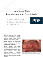 Gambaran Klinis Dan Histopatologis Pseudomembran Candidiasis