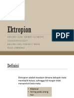 Ektropion