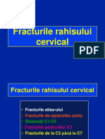 Fracturi-cervicale