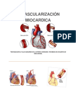 Revascularizacion miocardica 2