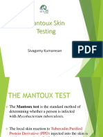 Mantoux Skin Testing: Sivagamy Kumaresan