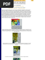 Kaplan's Cardinal Line in Hand Anatomy | PDF | Hand | Finger