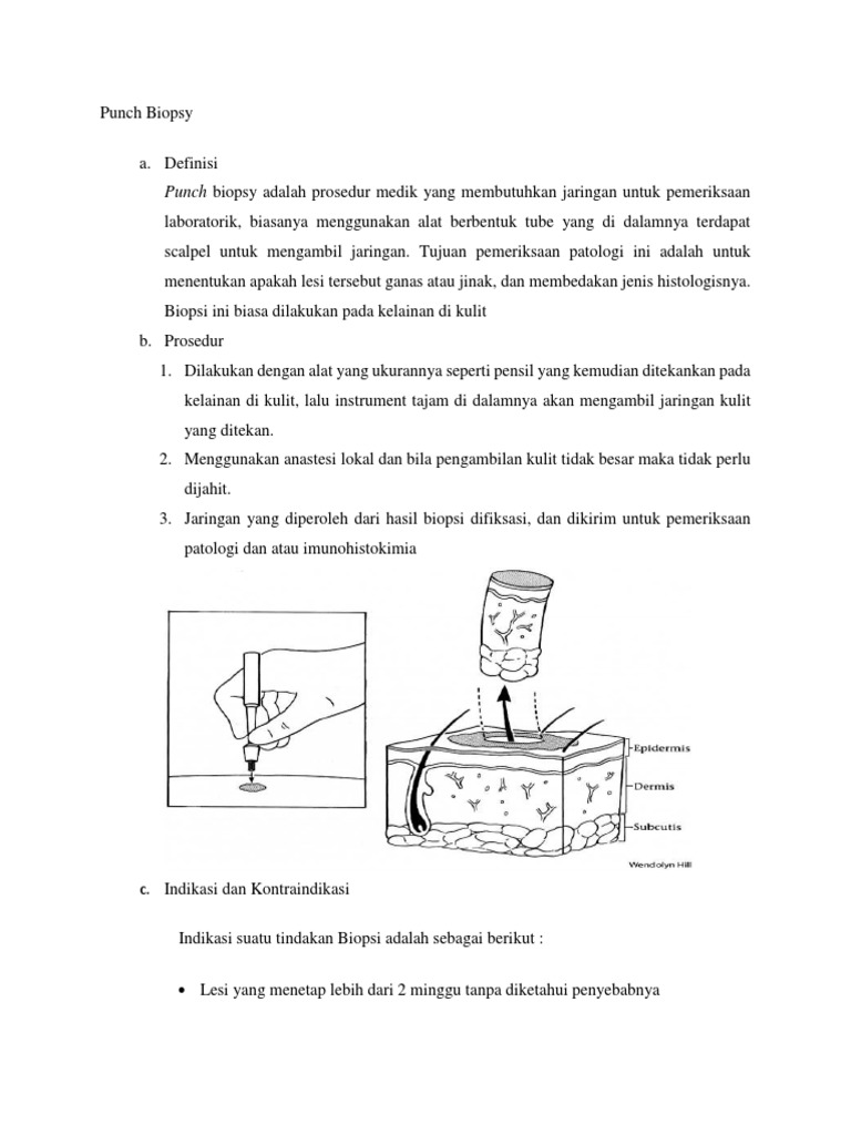 Punch Biopsy | PDF