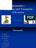 Diagnosis and Treatment of Eczema