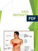 WC 3rd Week-Ileus Obstruktif