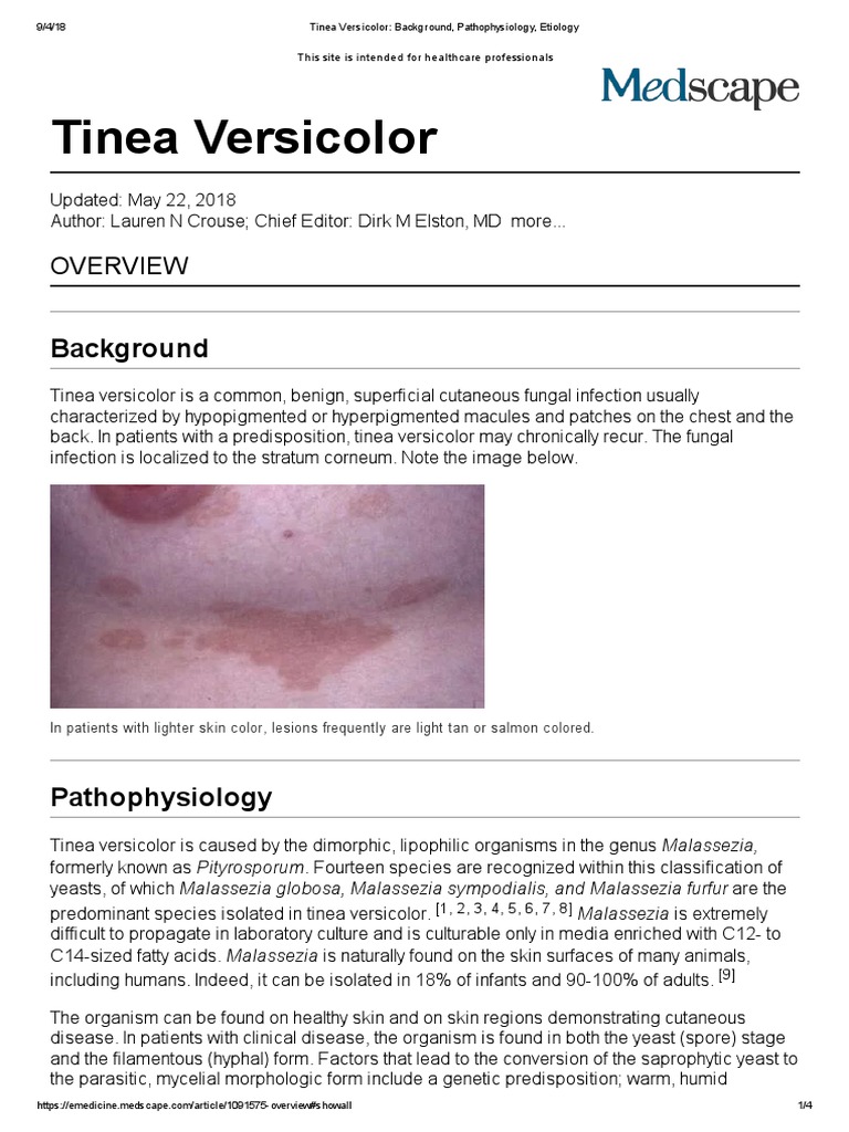 An Overview of Tinea Versicolor Background, Pathophysiology, Etiology