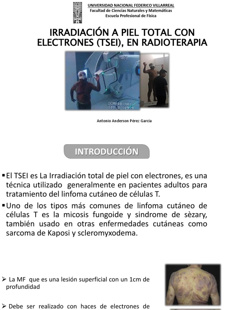 TSEI: Dosimetría en Radioterapia Cutánea | PDF | Dosimetría | Terapia ...