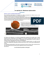 Membrane-epiretinienne.pdf