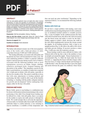 How To Feed Cleft Patient Breastfeeding Health Sciences