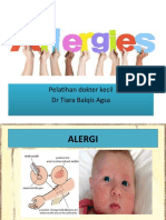 Alergi