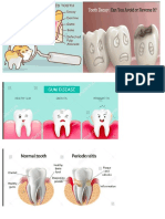 Dental Care