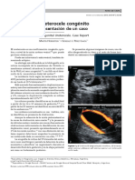 Ureteroccelle PDF