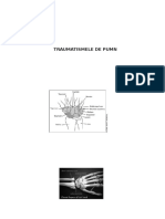 Traumatismele de Pumn