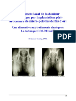 Goldtreat Traitement Douleur Arthrosique Par i Nstillation PÈri Articulaire Dimplant Dor