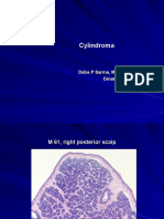 Cylindroma., M 61, Scalp