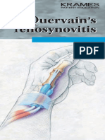 Dequervain's Syndrome