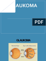 Tutorial Glaukomaa