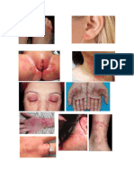 Dermatitis Por Contacto.pptx