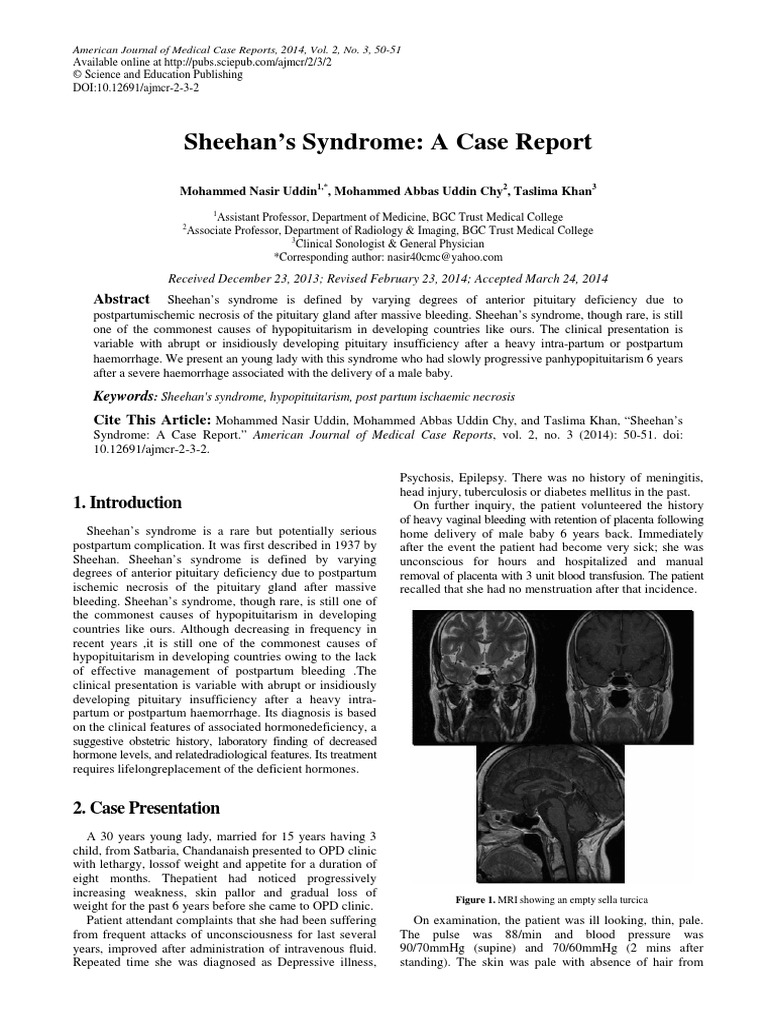 Sheehan's Syndrome A Case Report Keywords PDF Organ (Anatomy