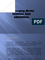 CT Imaging (Brain) Normal Dan Abnormal Guntur 1