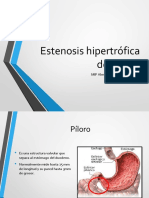 Estenosis Hipertrofica del Piloro.pptx