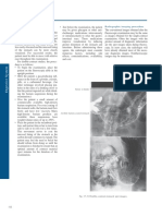 Double-Contrast Examination: Radiographic Imaging Procedure