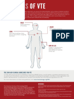 Signs of VTE Infographic