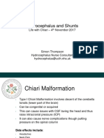 Hydrocephalus and Shunts Simon Thompson