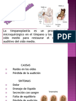 Timpanoplastia