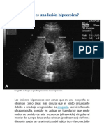 Qué Es Una Lesión Hipoecoica