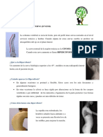 23 Hipercifosis.pdf