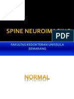 4. Neuroimaging Kelainan Vertebra (dr. Bekti).pptx