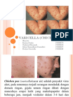 Varicella (Chickenpox)
