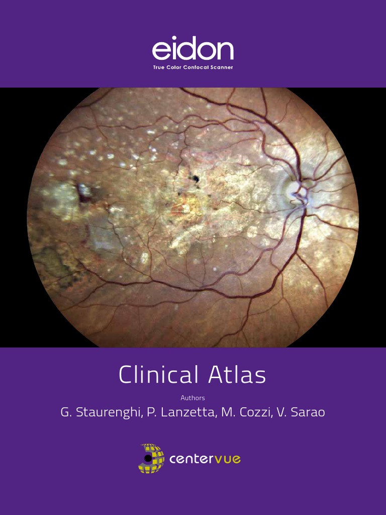 Eidon - Atlas Catalog Web | PDF | Retina | Sensory Organs