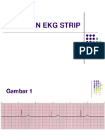 LATIHAN EKG STRIP.pdf