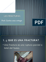 Tema 04 Las Fracturas